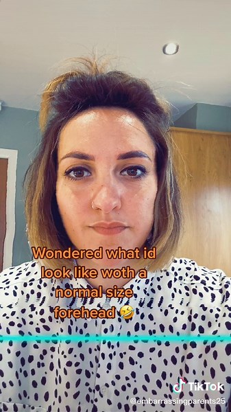 Understanding Forehead Size and Normal Forehead Dimensions