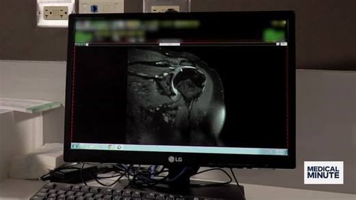 What is 'frozen shoulder?' How does the condition impact those with diabetes?