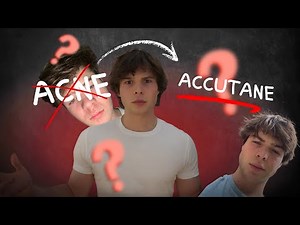 400 Days on Accutane: My Honest Review