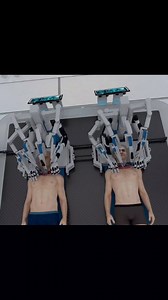 Head Transplant Surgery #shorts | MAX Gyan