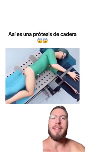 Así es como funciona una operación de prótesis de cadera.#pablopilatesreal #protesis #dolordecadera #artrosis #artrosisdecadera #protesisdecadera | Pablo.pilatesreal