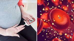 8 Signs of Gestational Diabetes, According to Science