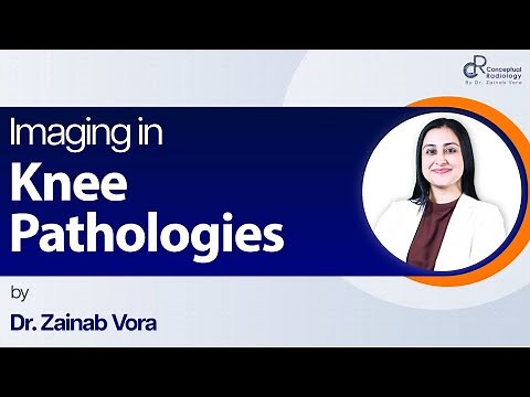 Imaging in Knee Pathologies by Dr. Zainab Vora | Conceptual Radiology | Radiology Residency
