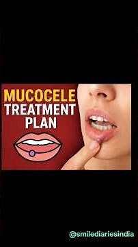 Mucocele Treatment Plan Explained in 180 Seconds and Precautions You MUST Know.Day-70.