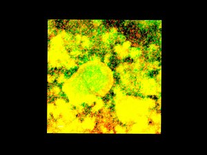 File:Selective-labelling-and-eradication-of-antibiotic-tolerant-bacterial-populations-in-Pseudomonas-ncomms10750-s6.ogv - Wikimedia Commons