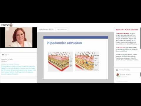 Criolipólisis plana ¿por qué es mejor?