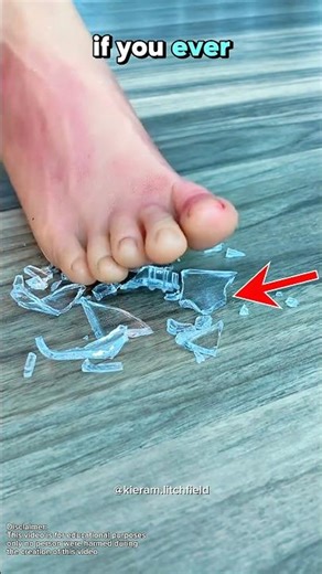 Simple Steps to Get Glass Out Safely😳