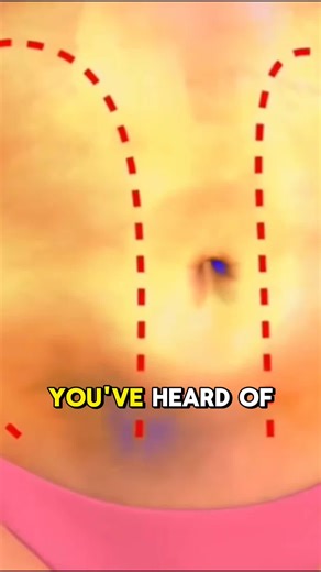 Liposuction Explained: Science Behind Fat Removal