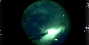 Vitreoretinal Surgery With Intraoperative Fluorescein Angiography - Eyetube