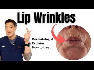 Why Do Women Get Upper Lip lines | Dermatologist explains Causes & Solutions
