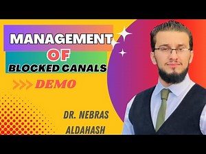 Management of blocked canals || Dr.Nebras Aldahash