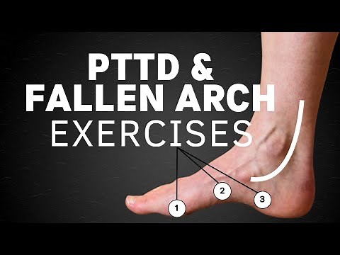 PTTD Exercises | Fallen Arches Exercises by a Foot Specialist