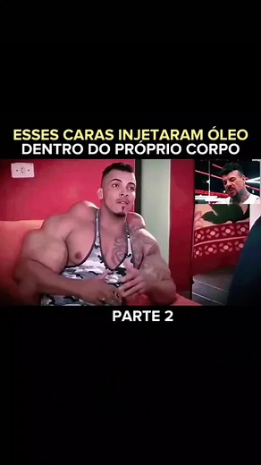 Dicas de Musculação: Cuidado com Injeções de Óleo