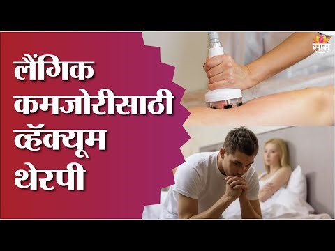 SJM | लैंगिक कमजोरीसाठी व्हॅक्यूम थेरपी | Vacuum Therapy for Sexual Weakness