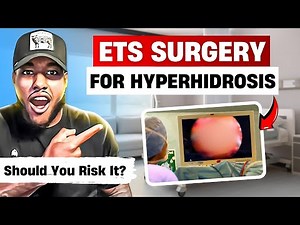 Surgery For Hyperhidrosis | Endoscopic Thoracic Sympathectomy (ETS) Explained