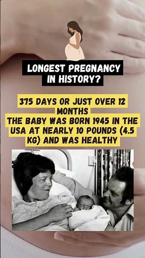Guess the longest Pregnancy in History! Insane Time! ⏰