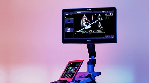 Vivid Colour, Vivid Imaging, Vivid Diagnosis EDAN Ultrasound Acclarix LX9, explaining vividness to the world. #EDAN #Ultrasound #MedicalDevices #Healthcare | EDAN