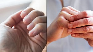 Simple finger test you can do at home to see if you're suffering from serious health problem