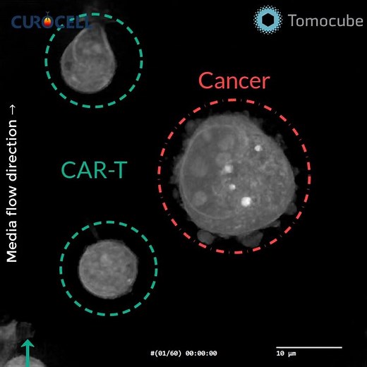 [Holotomography] CAR T-cells attacking a cancer cell