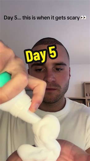 Day 5 of My Hair Transplant Journey: Scab Care Tips