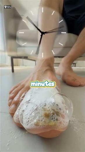 Toenail Fungus Treatment #shorts #ytshorts #health
