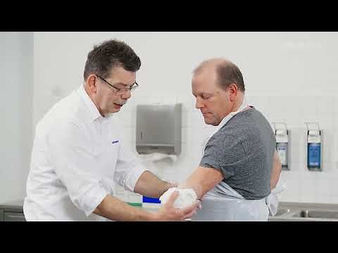Transradial Casting Technique | Ottobock