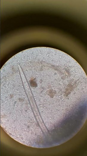 Hookworm adultworm #microbiology #parasitology #stool #microscopy