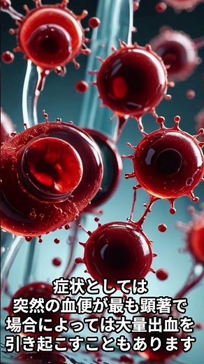 突然の血便の原因かも!?大腸憩室出血とは? #shorts