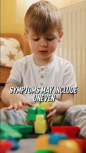 Top 4 Exercises for Hip Dysplasia Relief: Quick Guide! #shorts