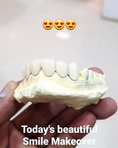 16K views · 70 reactions | It's really one of the best smiles I've ever done . Perfectly white, beautiful design work. . . "Dr. Ali Rashid's Dental Clinic" RJ Mall, 3rd Floor, Gulshan Iqbal Block 10-A, near millennium mall, Karachi Timing: Everyday 12-8 Contact 1 hour before visiting: 03362048058 | Dr. Ali Rashid | Facebook