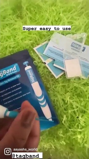 Watch me remove my skin tag // Before & after removal from home