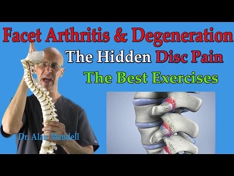 Facet Arthritis & Degeneration (The Hidden Disc Pain) Best Exercises - Dr Mandell