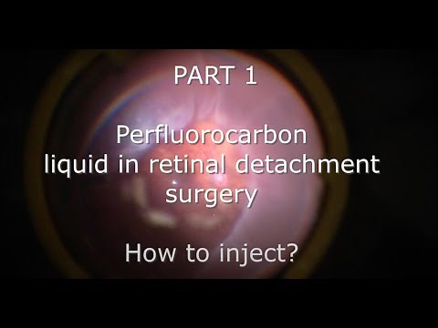 Part 1. Basics of perfluorocarbon liquid use: How to inject and what to avoid
