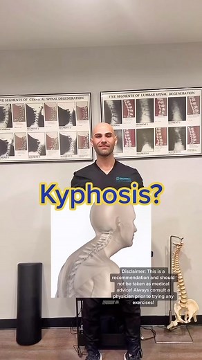 Improve Your Posture with These Kyphosis Exercises