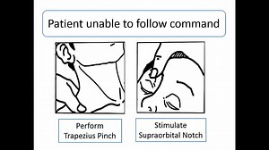 Best Motor Response-GCS