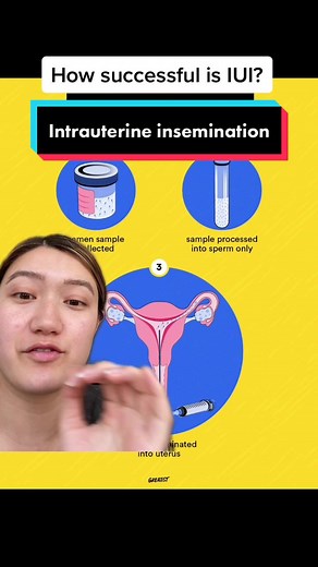 Understanding the IUI Process: Success Stories, Procedures, and More