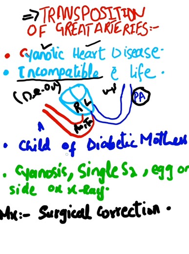 Transposition Of Great Arteries #congenitalheartdefects #Cyanosis #tetralogyoffallot