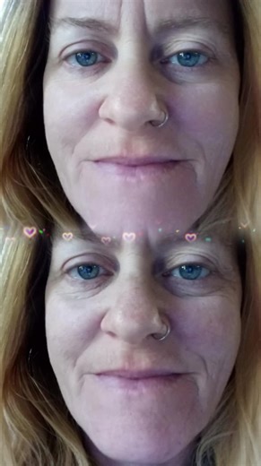 NAD  BIO Lifting-sil Essence: Perfect Skin in Days