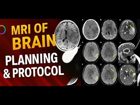 MRI of Brain Planning | Positioning, Sequences & Protocol Explained