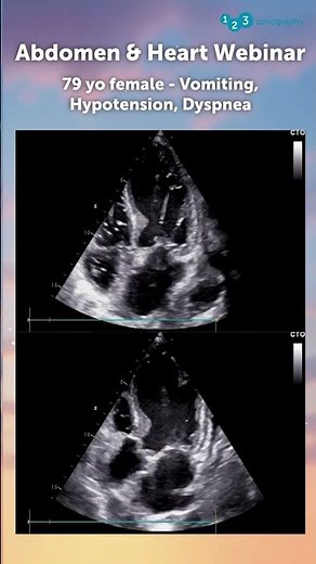 Case: 79-year-old female - Vomiting, Hypotension, Dyspnea