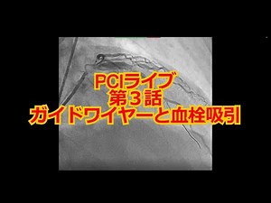 【心カテ】PCIライブ 第３話 ガイドワイヤーと血栓吸引について