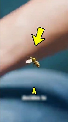 Never Pull Out a Bee Stinger Like This! 🐝 The Right Way Could Save You More Pain