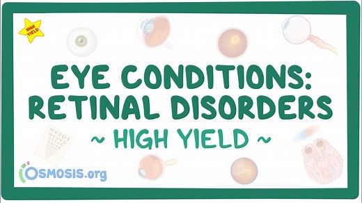 Eye conditions: Retinal disorders: Pathology review: Video, Causes, & Meaning | Osmosis