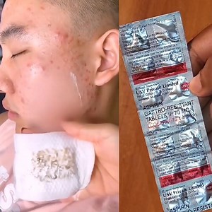 732K views · 5.9K reactions | Mix aspirin with egg to get glowing and wrinkle - free skin, botox with only 2 ingredients #glowingskin #wrinkles #antiaging #diy #homemade #beauty #skincare #pigmentation | Anmol Hindi | Facebook