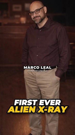 First Ever Alien X-Ray Revealed