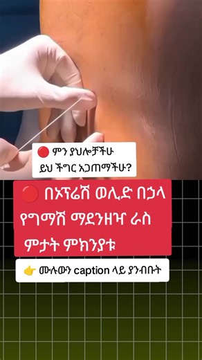 🔴 ድህረ-ወሊድ የግማሽ ማደንዘዣ ራስ ምታት: ስለምክንያቱ ማወቅ ያለብዎት ጉዳይ 📌 በግማሽ(በአከርካሪ የሚሰጥ) ማደንዘዣ ብዙ ጊዜ ከሚሰሩ ኦፕሬሽኖች መካከል በኦፕራሲዎን መውለድ(C-Section) ዋናው ነው። 📌 በዚህም ራስ ምታት ከወሊድ በኋላ የሚከሰት የተለመደ ችግር ነው። መንስኤው። 👉 በህብለሰረሰር ዙሪያ ያለው ጠንካራ ሽፋን ሲበሳ፣ፈሳሽ (CSF) ሊወጣ ይችላል። 👉 ይህ መፍሰስ በአንጎል እና በአከርካሪ ነርቭ ዙሪያ ያለውን ግፊት መጠን ይቀንሳል ይህም ወደ ራስ ምታት ይመራል። 👉 ራስ ምታቱ በሚቀመጡበት ወይም በሚቆሙበት ጊዜ በጣም የከፋ ሲሆን በሚተኛበት ጊዜ ይሻሻላል። 📌 ለራስ ምታት አስተዋፅዖ የሚያደርጉ ቁልፍ ነገሮች የሚከተሉትን ያካትታሉ፡- ✅ ማደንዘዣ በሚሰጥበት ጊዜ መጠኑ ከፍ ያለ ፈሳሽ መፍሰስ ✅ ትልቅ መጠን ያለው ማደንዘዣ መስጫ መርፌዎች መጠቀም ✅ ከዚህ