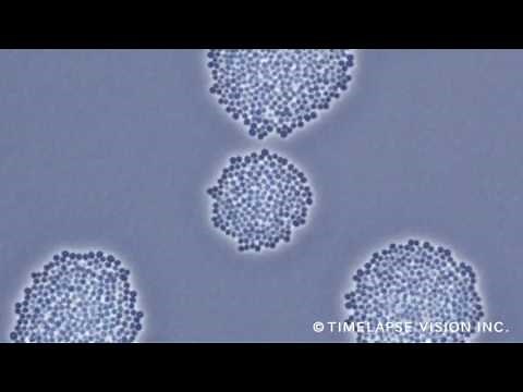 Growth of MRSA -メチシリン耐性黄色ブドウ球菌の増殖-
