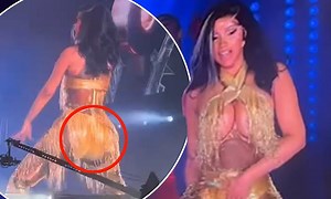 Cardi B suffers a wardrobe malfunction as her outfit rips on stage