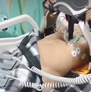 9.4M views · 9.9K reactions | massage cardique par maLe système Lucas™ (Lund University Cardiac Arrest System), | Dr Brahim Réa | Facebook