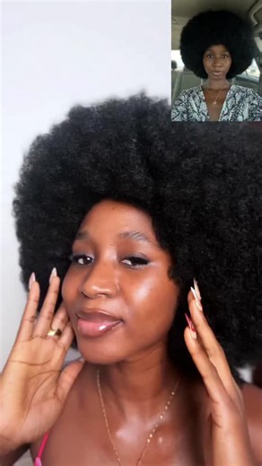 PRINCESS | CONTENT CREATOR | MODEL🇳🇬 on Instagram: "“From dull to glowing — this is my real skincare journey 🤍✨” @miraskincareng @miraskincare_products"